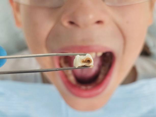 Best After-Hours Dental Care in Line Acres, MO